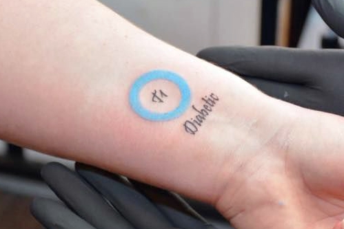 Tetoválás cukorbetegség, vannak kockázatok vagy problémák? | Tetoválás