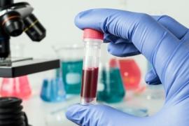 Kaposváron is lesz névtelen hepatitis C szűrés szombaton